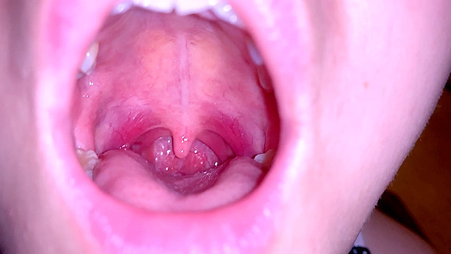 水沢つぐみの喉奥責め 腫れ気味な扁桃腺を…