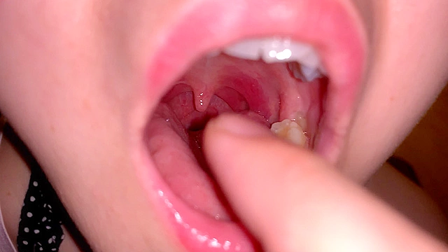 水沢つぐみの喉奥責め 腫れ気味な扁桃腺を…