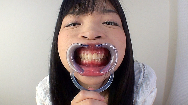 歯10