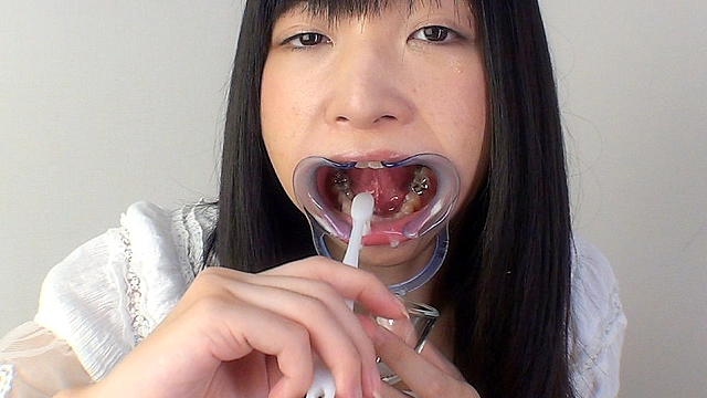 歯10