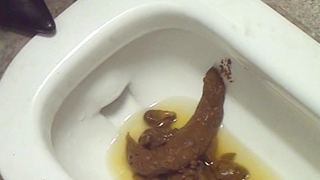 大便排泄視感2