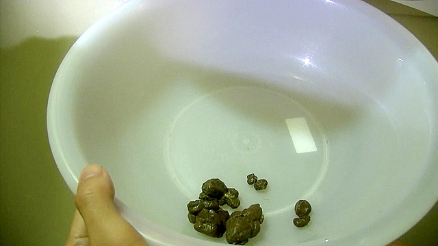 妄想うんこ劇場 序章 吸血バニーのうんこを手に入れろ！「口を開けろ糞人間！」～桜夜まよい