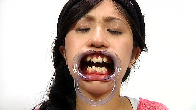 歯13