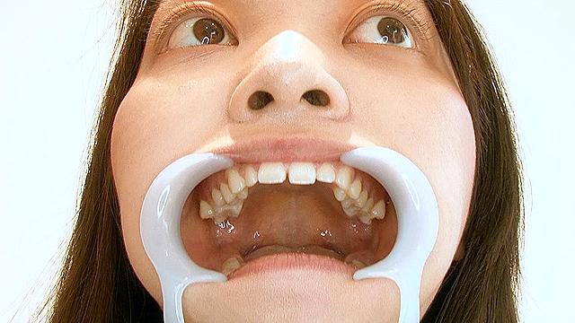 歯フェチ！本物の歯治療映像【抜歯】 ミランダ