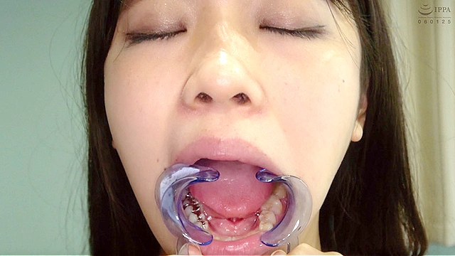 【歯・口内】人気女優 永野楓果チャンの歯・口内のどちんこ観察！！