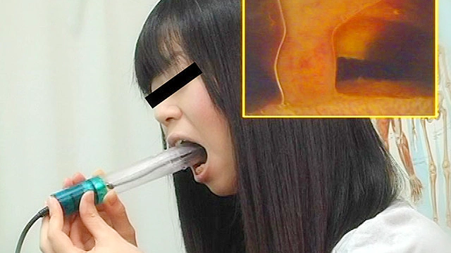 肛門科 腸内カメラ・脱糞 ○撮3