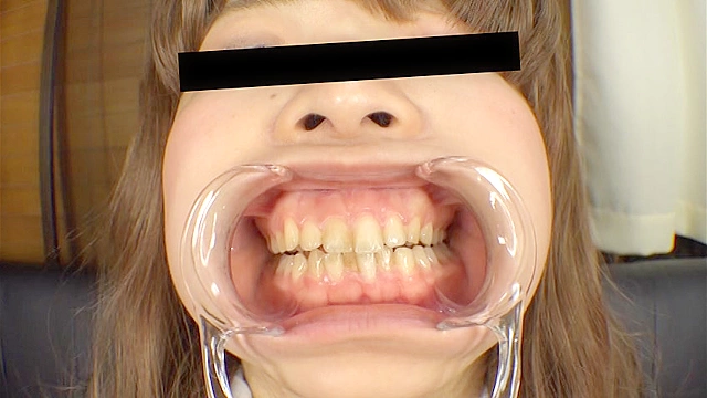 お姉さん達の口の中 口腔観察で感じる女達