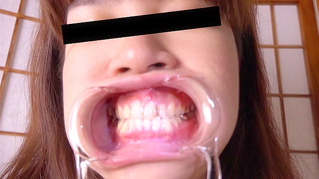 お姉さん達の口の中 口腔観察で感じる女達