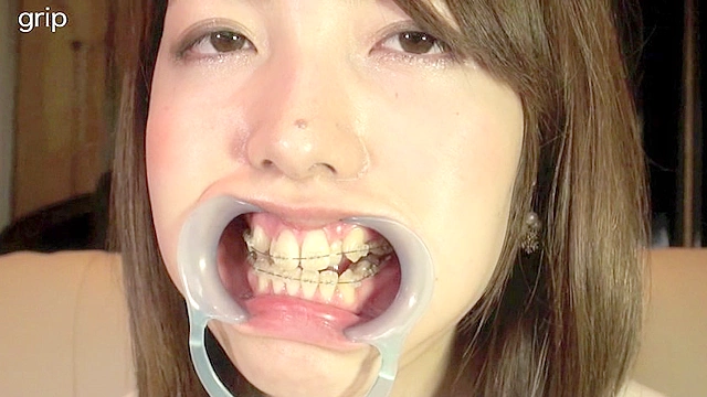 フェチ選！！羞恥歯科医淫！おっぴろげ口腔紀行
