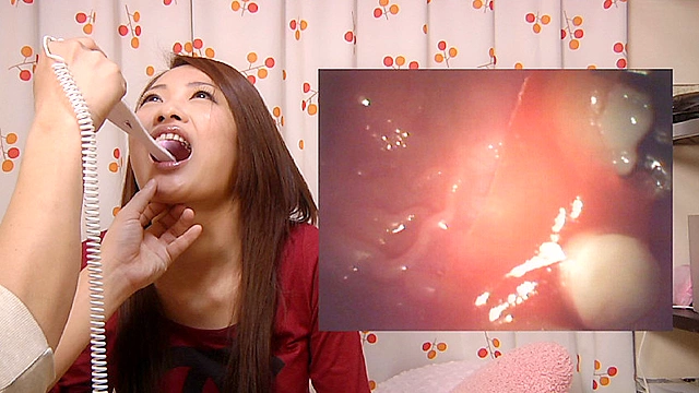 激レア！歯観察 差し歯の恋ちゃん