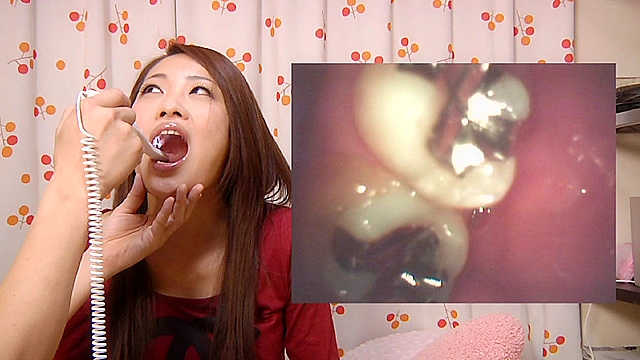 激レア！歯観察 差し歯の恋ちゃん
