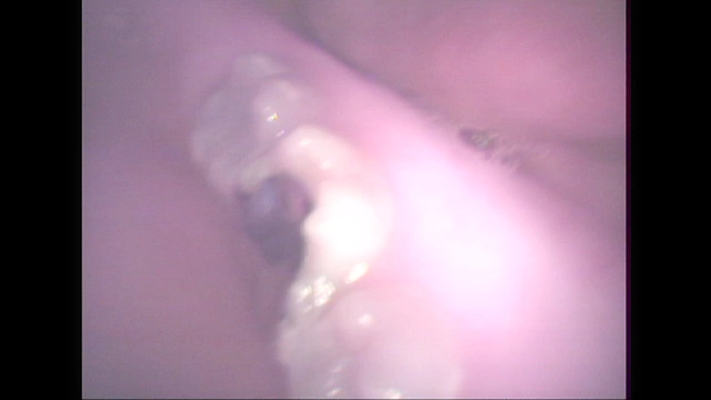 歯12