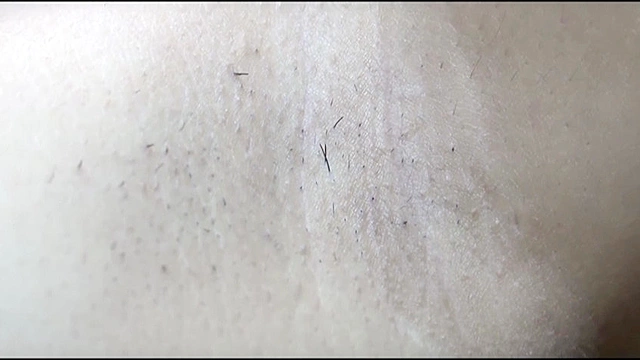 M男のための「脇」