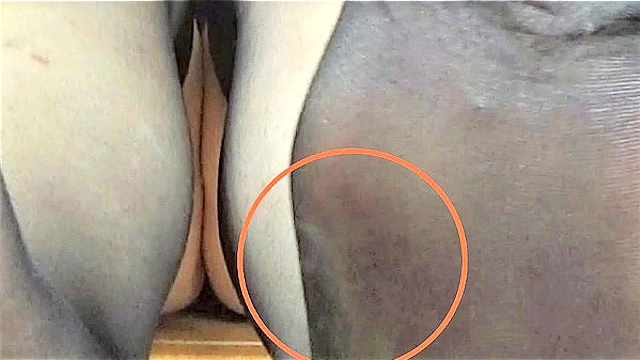 【足のにおい】粉ふきゴワゴワ