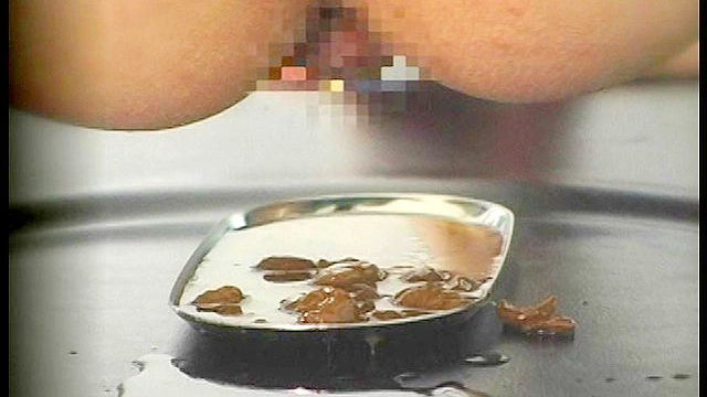 肛門科 腸内カメラ・脱糞 ○撮2