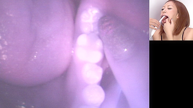 歯08