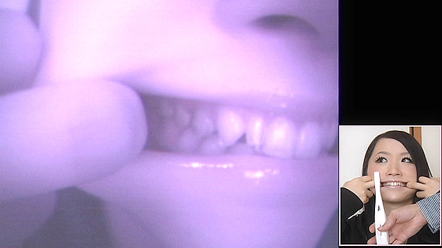 歯19