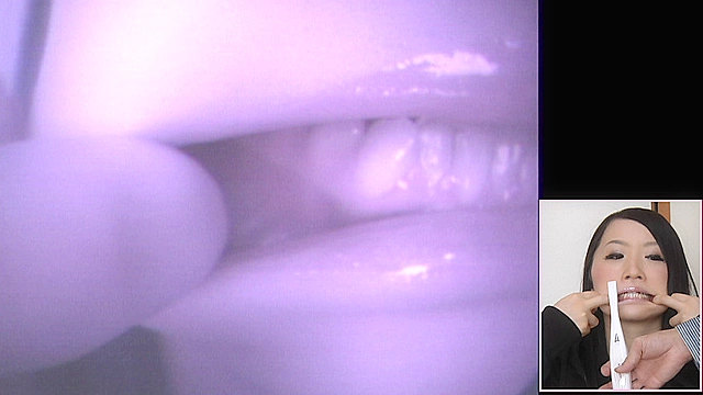 歯19