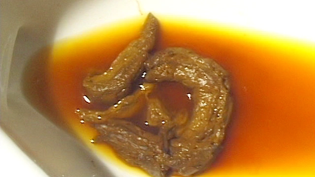 大便法典12