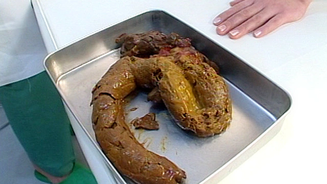 排泄病棟08