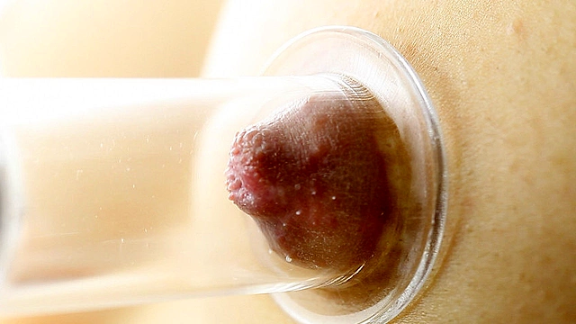 Inverted nipple