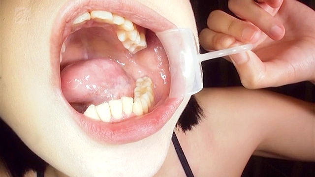 歯が1本ない親知らずあり口腔◎唾液スコールと口臭の風に吹かれて