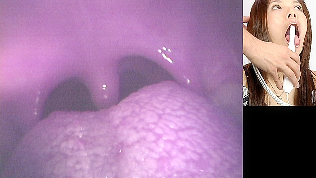 歯09