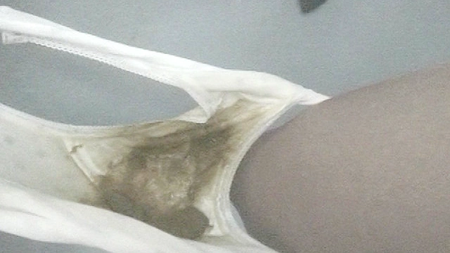 失便3