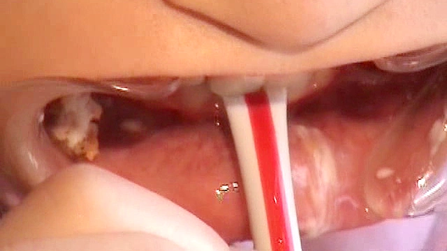 開口で食事03