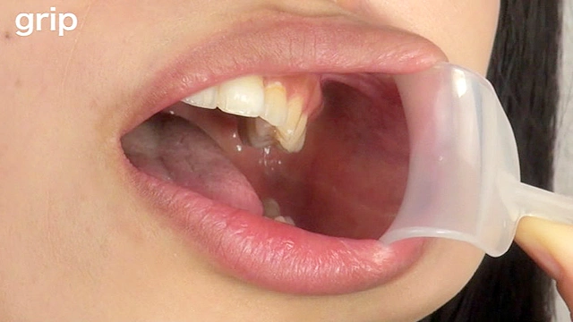 口腔粘膜剥き出し絶頂！！開口狂器 倉科もえ