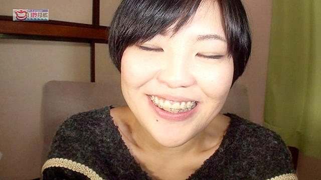 口腔ドキュメント 歯列矯正中の女 美紀・21歳（矯正5年目）