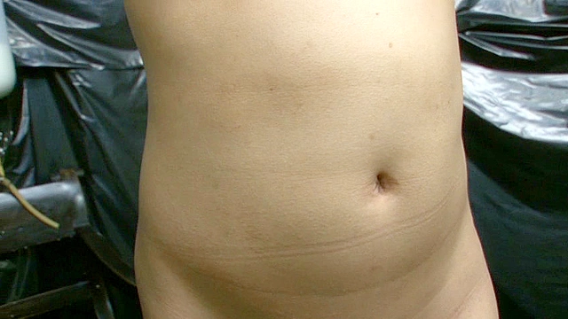 牛乳浣腸3リットル4
