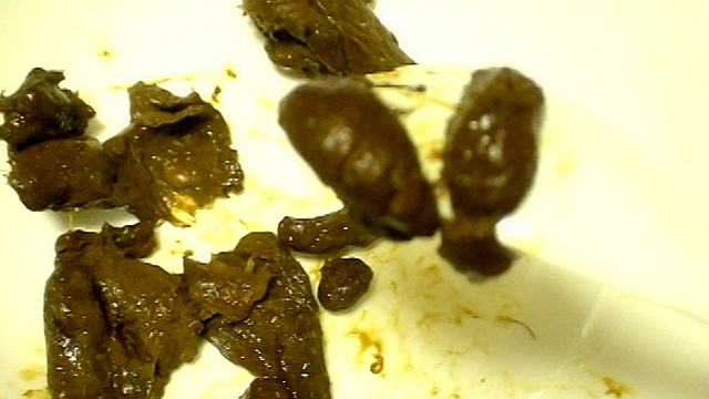 糞一週間