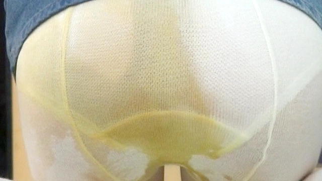 失便