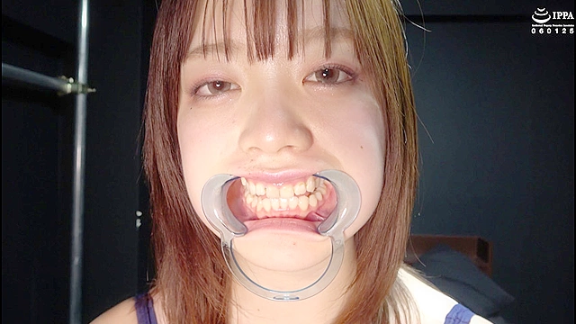 大人気女優 橋本りこチャンの歯・口内・舌ベロ観察プレイ！！！