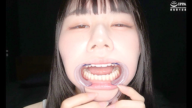 【激カワ美女の超レアな歯・口内・銀歯・のどちんこ観察！】月美りょう