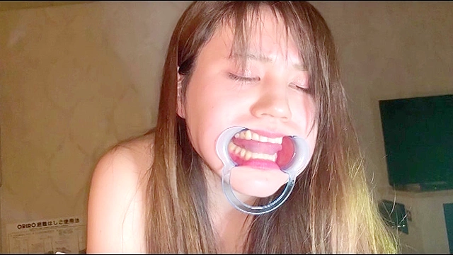 口腔（1）