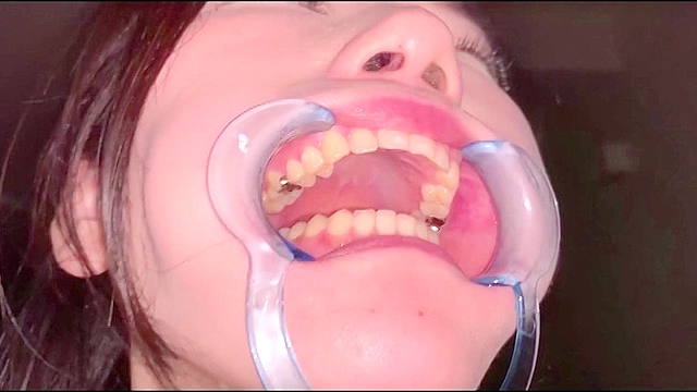 口腔（1）
